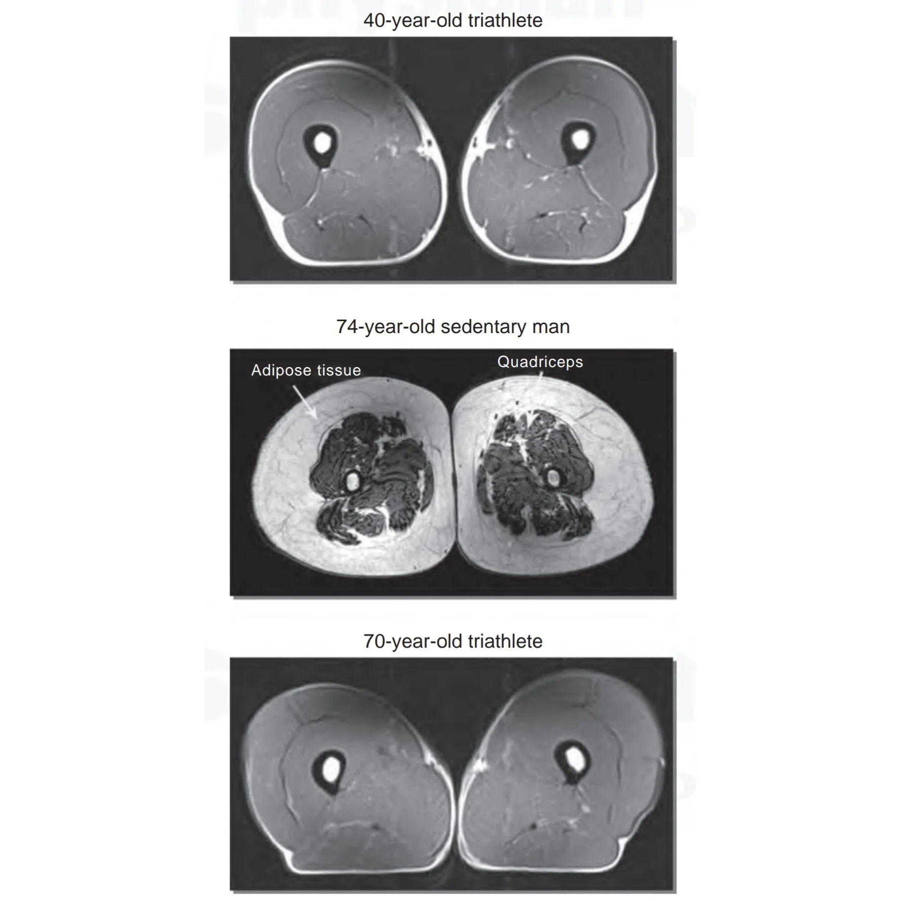 Spieren verouderen niet – als je traint. Hier is het bewijs.